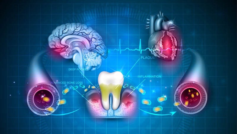 The Connection Between Periodontal Disease and Systemic Health Issues