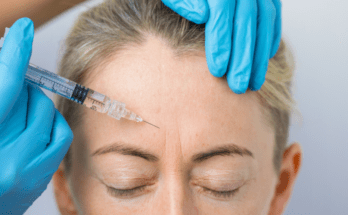 Skin Rejuvenation