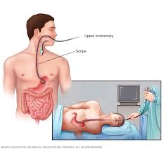 Colonoscopy